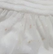 怎么去除衣服上的Ҏ(gu)Q? title=